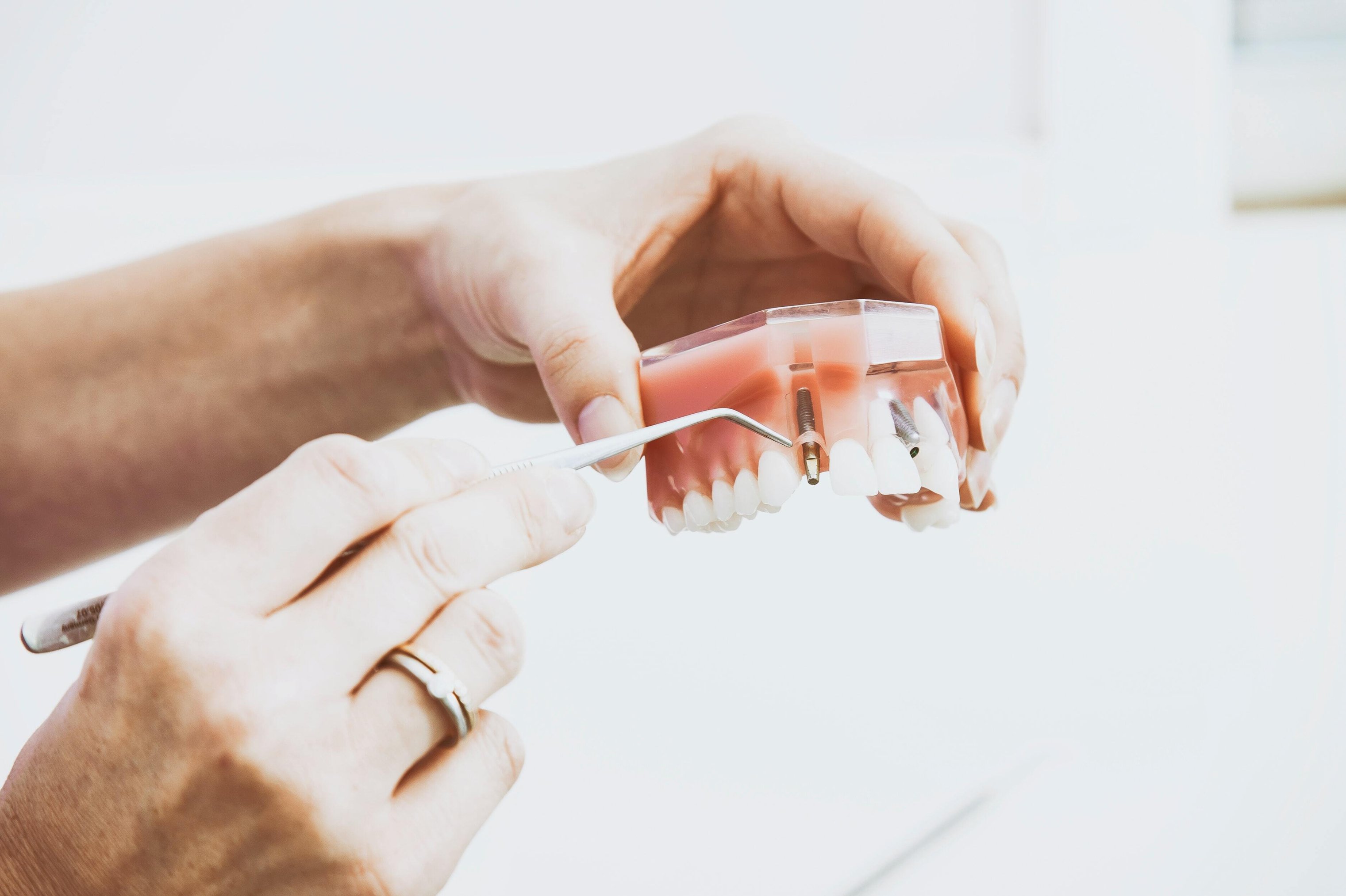 Discover the benefits of dental implants in Nottingham