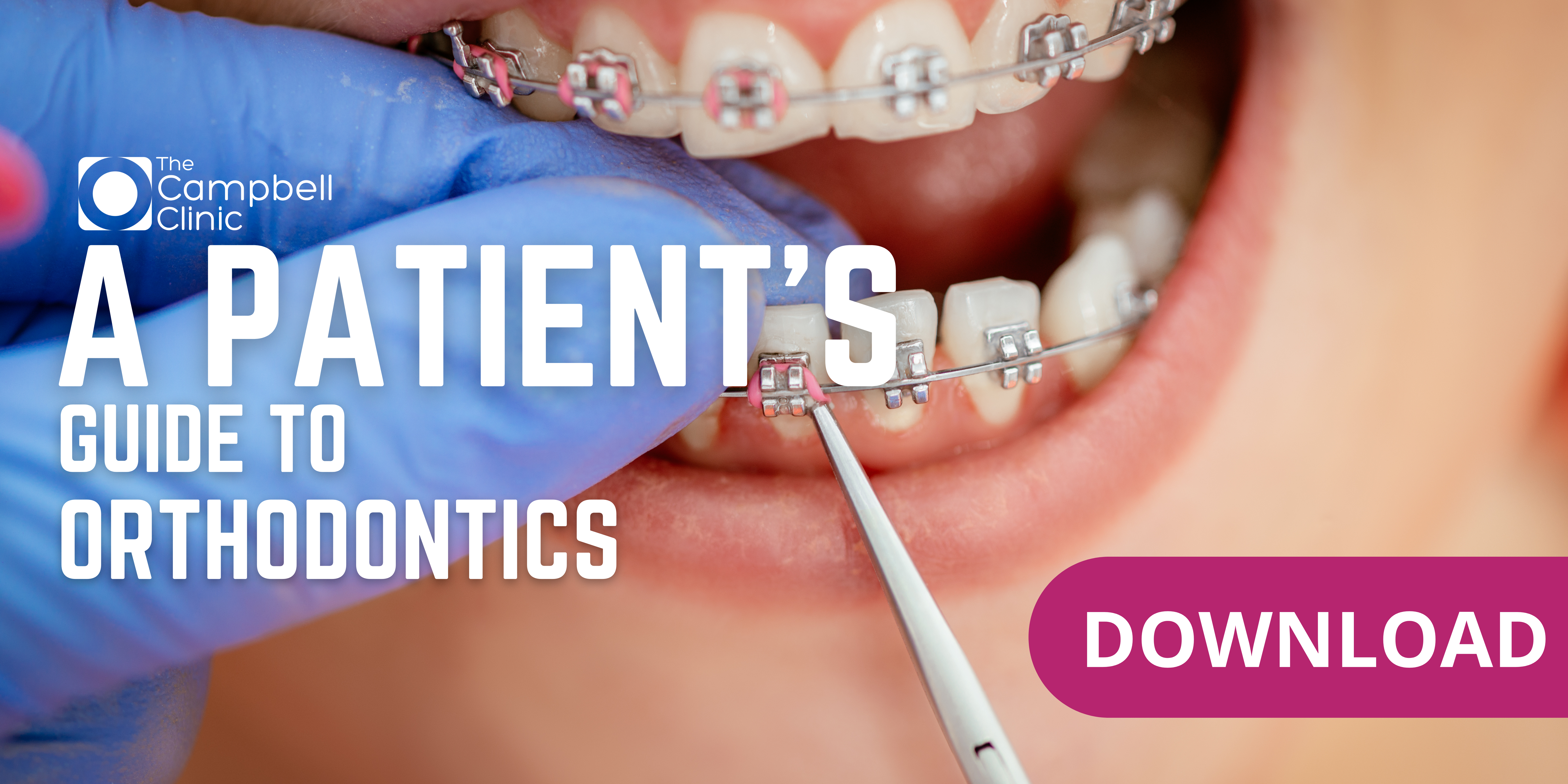 Patients guide to Orthodontics
