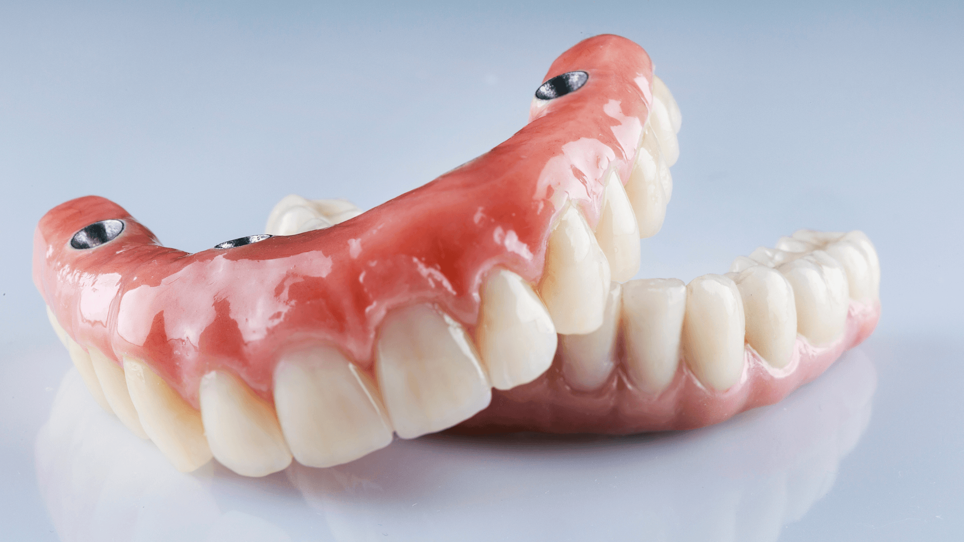 Same day dental implants Nottingham