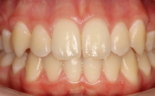 After -The Campbell Clinic