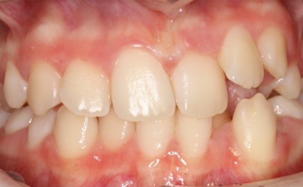 Before - The Campbell Clinic