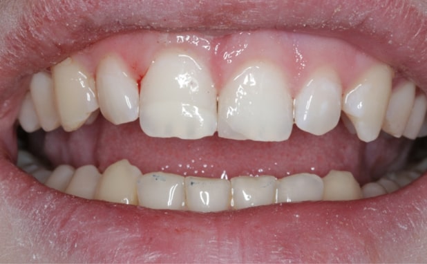 After -The Campbell Clinic