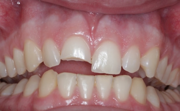 Before - The Campbell Clinic