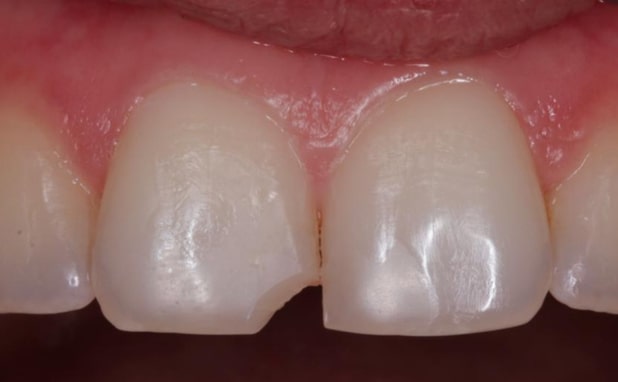 Before - The Campbell Clinic