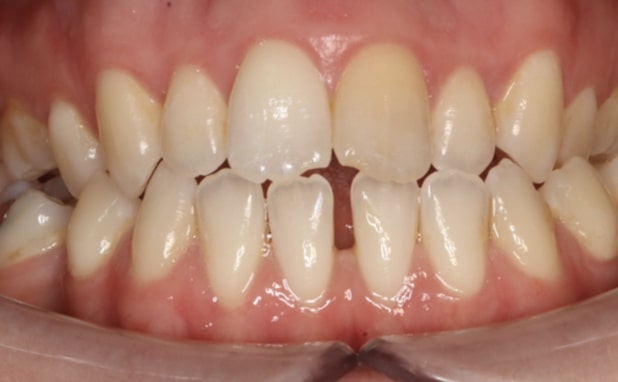 Before - The Campbell Clinic