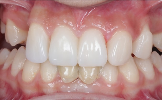 After -The Campbell Clinic