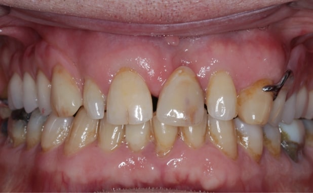 After -The Campbell Clinic