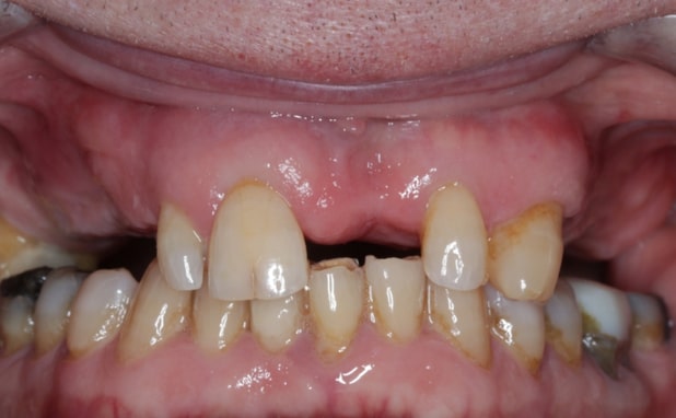 Before - The Campbell Clinic