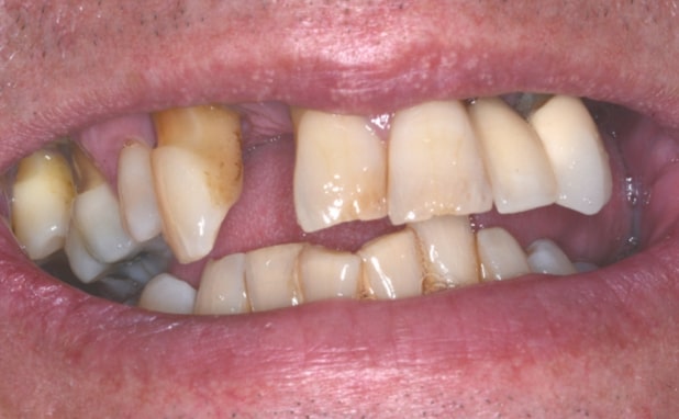 Before - The Campbell Clinic