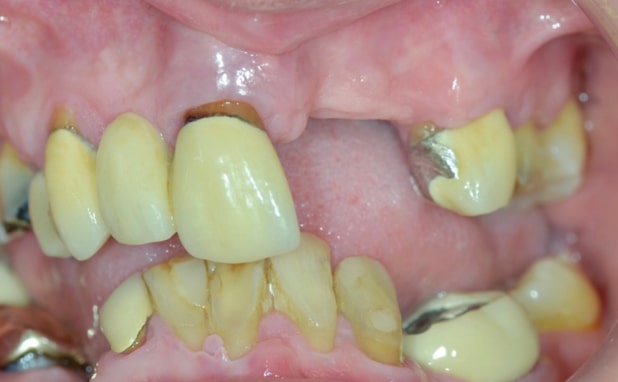 Before - The Campbell Clinic