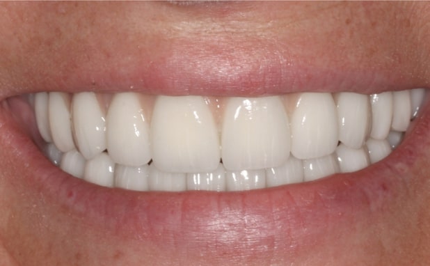 After -The Campbell Clinic