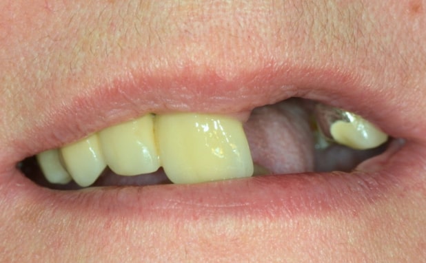 Before - The Campbell Clinic