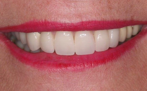 After -The Campbell Clinic