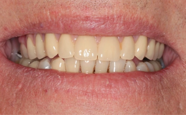 After -The Campbell Clinic