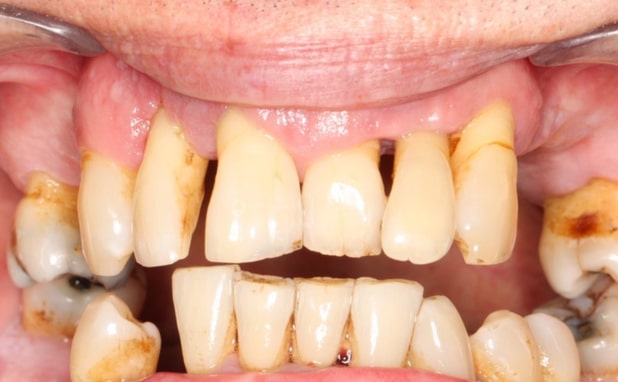 Before - The Campbell Clinic