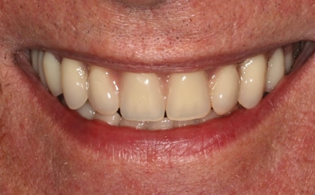 After -The Campbell Clinic