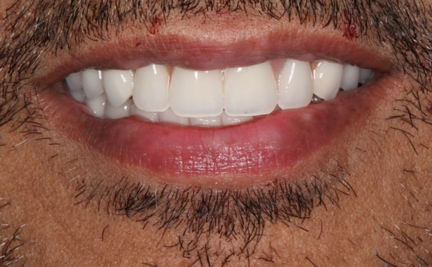 After -The Campbell Clinic