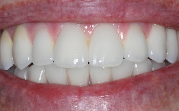 After -The Campbell Clinic