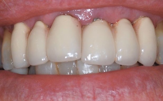 Before - The Campbell Clinic