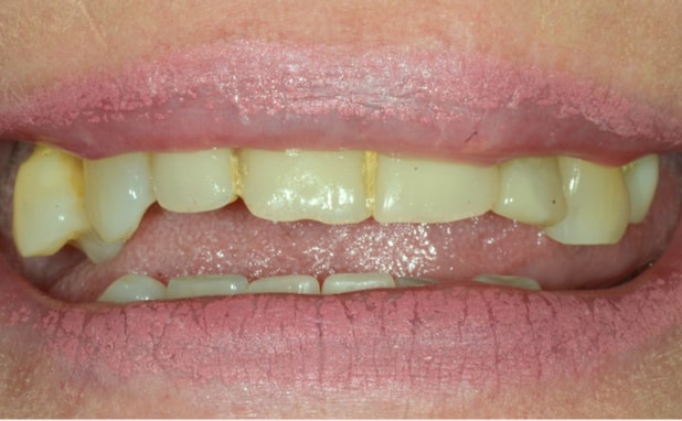 Before - The Campbell Clinic