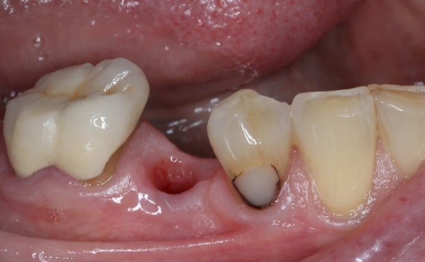 Before - The Campbell Clinic