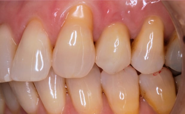 After -The Campbell Clinic