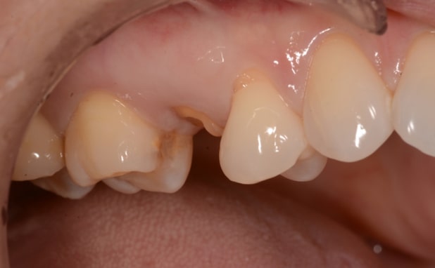 Before - The Campbell Clinic