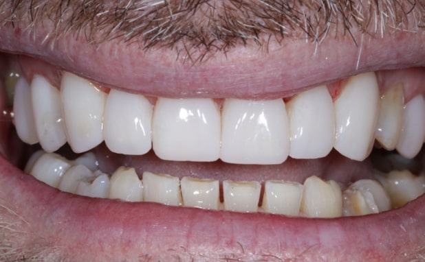 After -The Campbell Clinic