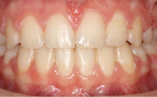 After -The Campbell Clinic