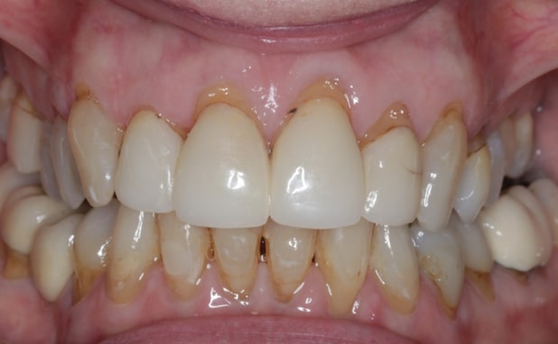 Before - The Campbell Clinic