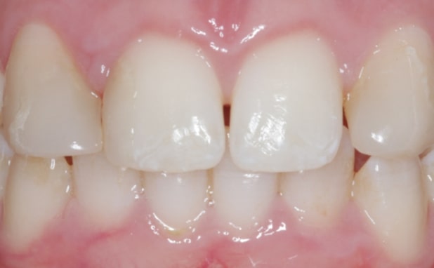 Before - The Campbell Clinic