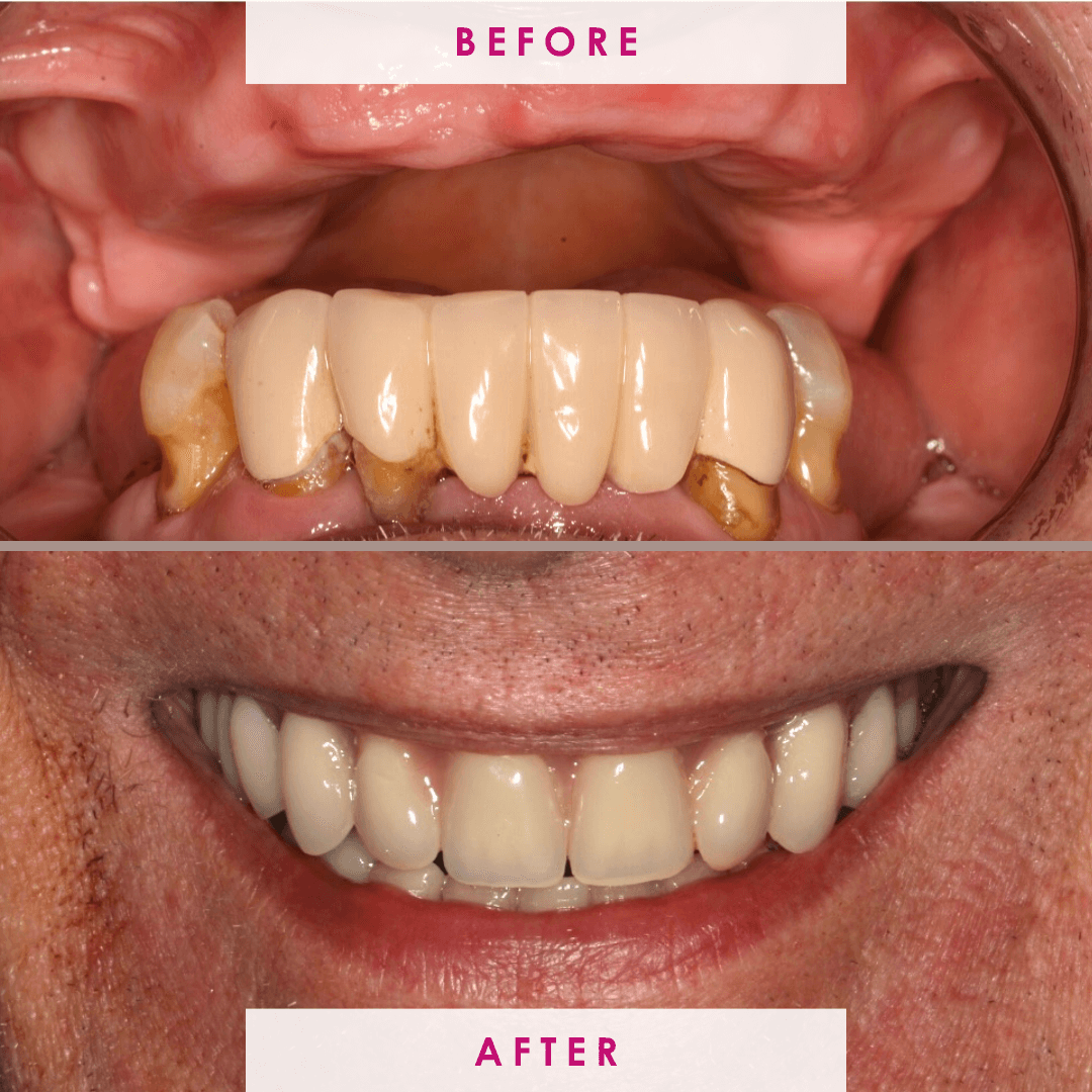 After -The Campbell Clinic