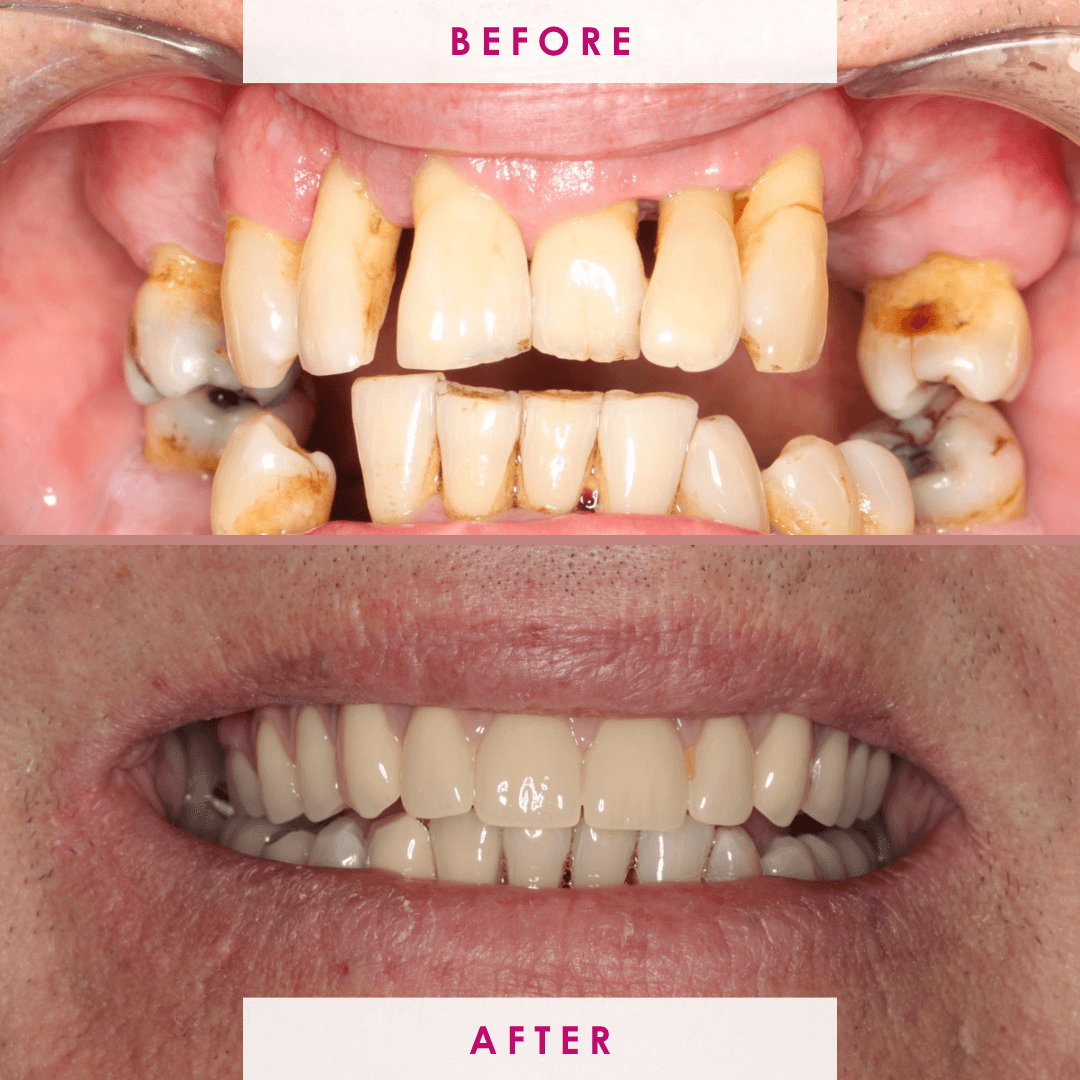 After -The Campbell Clinic