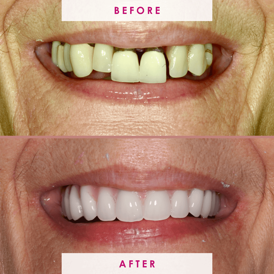 After -The Campbell Clinic