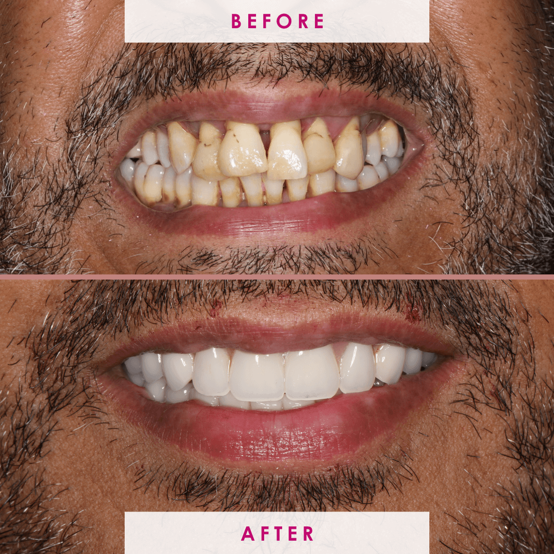 After -The Campbell Clinic