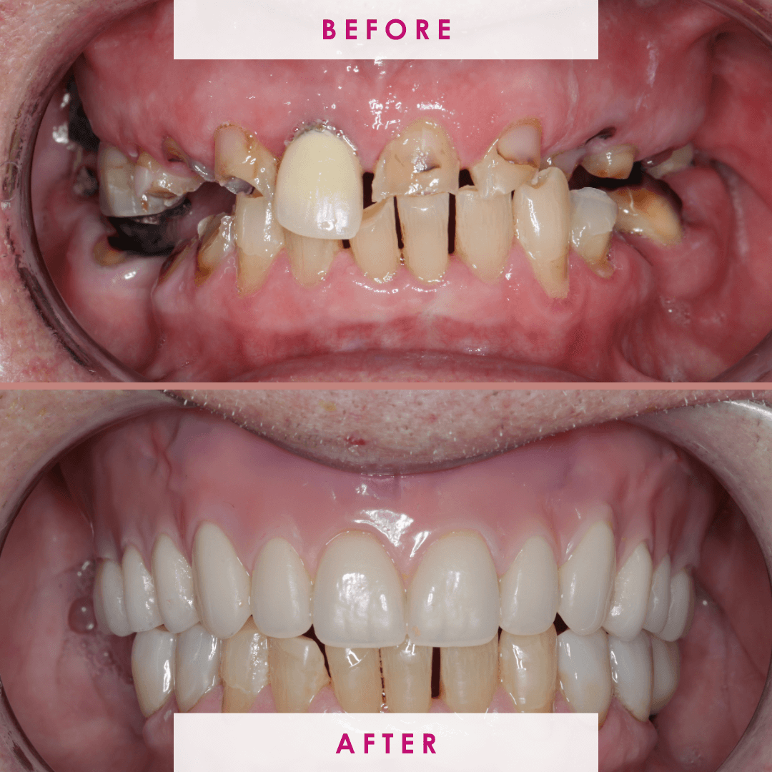 After -The Campbell Clinic