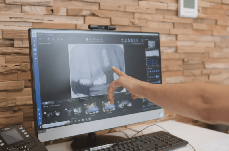 Blog - The Campbell Clinic