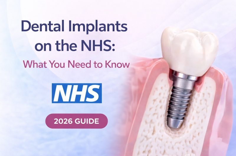 Dental Implants NHS